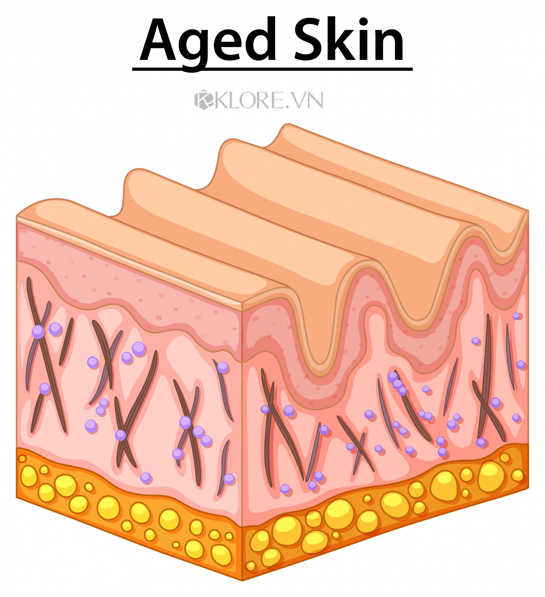 aged_skin